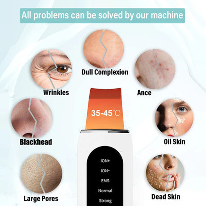 Glammry™ Heated Ultrasonic Skin Scrubber